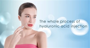 Întregul proces de injectare a acidului hialuronic